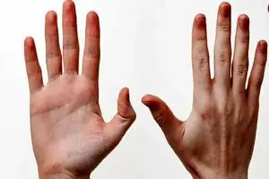 چرا انسان‌ها راست‌دست شدند؟