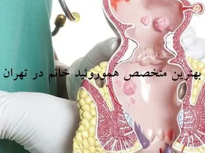 دکتر خانم متخصص هموورئید در غرب تهران