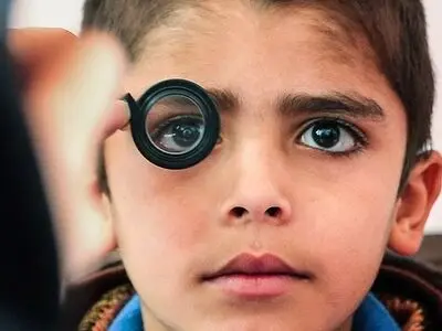 آغاز طرح سراسری پیشگیری از تنبلی چشم کودکان/ پیشگیری از نابینایی در 3 سالگی