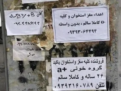 ماهی ۷۰ میلیون هزینه درمان بدون بیمه و حمایت/ خواستم کلیه‌ام را بفروشم، نشد.....