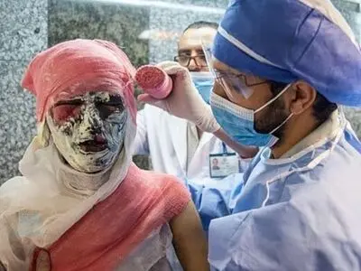 19 مصدوم تلفات چهارشنبه سوری کرمانشاه تا کنون