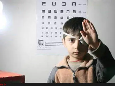 رشد اختلالات بینایی در جنوب و جنوب شرق کشور/نبود متخصص و گرانی قیمت عینک از دلایل افزایش شیوع تنبلی چشم