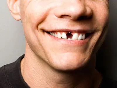 «شرم از لبخند» درد جدید ایرانیان فقیر شده 