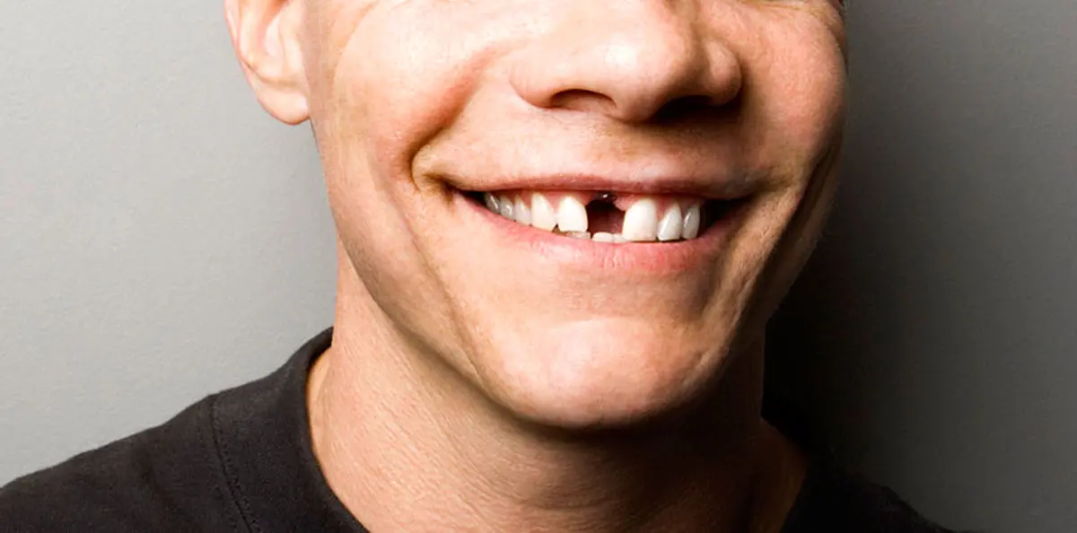 «شرم از لبخند» درد جدید ایرانیان فقیر شده 