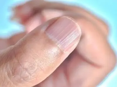 ژل ناخن کاری چه بلای سر دست‌تان می‌آورد؟