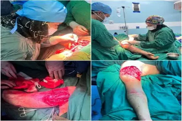 ترمیم دست قطع‌شده یک جوان طی عمل جراحی پیچیده ۶ ساعته در بیمارستان فاطمی اردبیل 