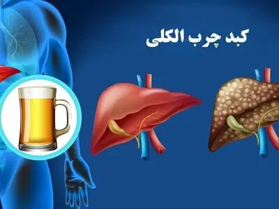 الکل دوز امن ندارد؛ آسیب‌های کبدی ممکن است تا مراحل پیشرفته خاموش بمانند
