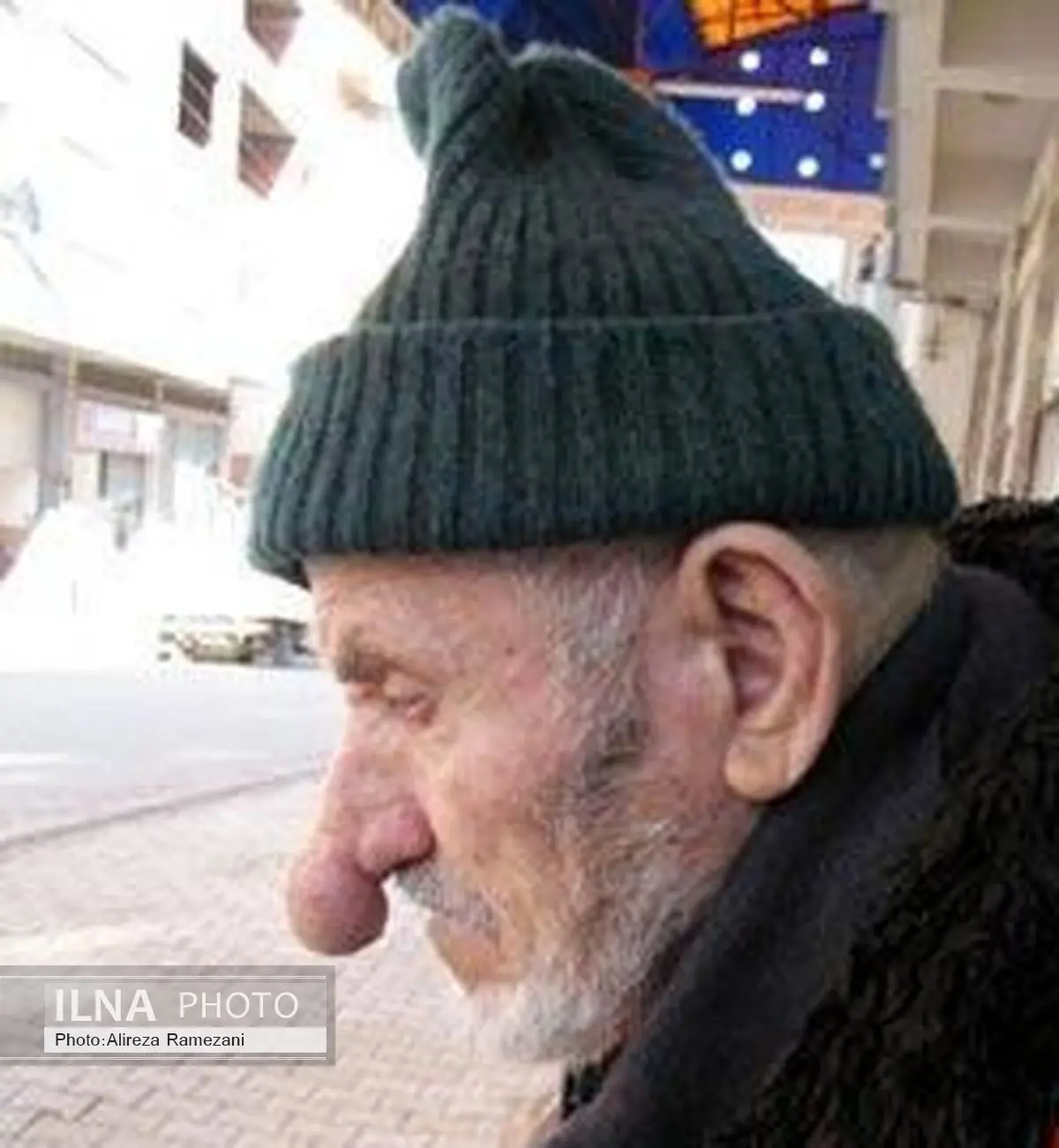 درازترین بینی جهان +عکس 