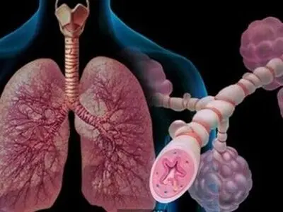 توصیه حیاتی به مبتلایان آسم؛ شهریور این واکسن را تزریق کنید