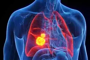 کاهش خطر ابتلا به سرطان با مصرف این ماده غذایی