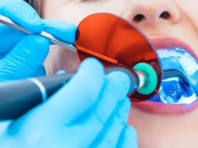 بهترین متخصص کامپوزیت دندان چه کسی است؟