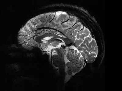 نخستین تصاویر مغزی ثبت‌شده توسط قوی‌ترین دستگاه MRI جهان