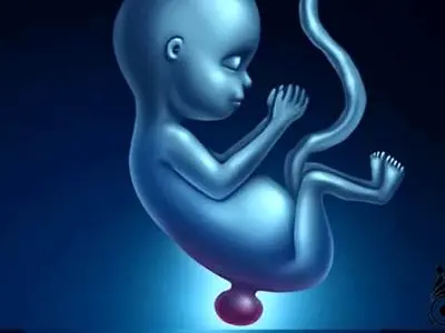 وجود ۲ میلیون بیمار مبتلا به مننوگسل در کشور/ شیوع بیماری در شهرهای گرمسیری بیشتر است