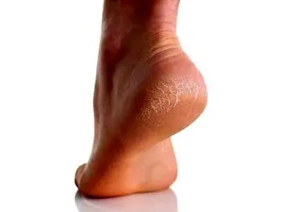 asdasd