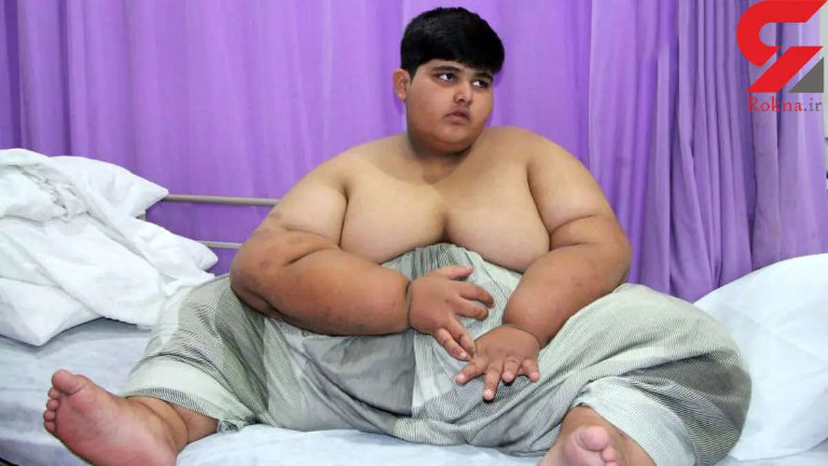 محمد 10 ساله چاق ترین کودک جهان