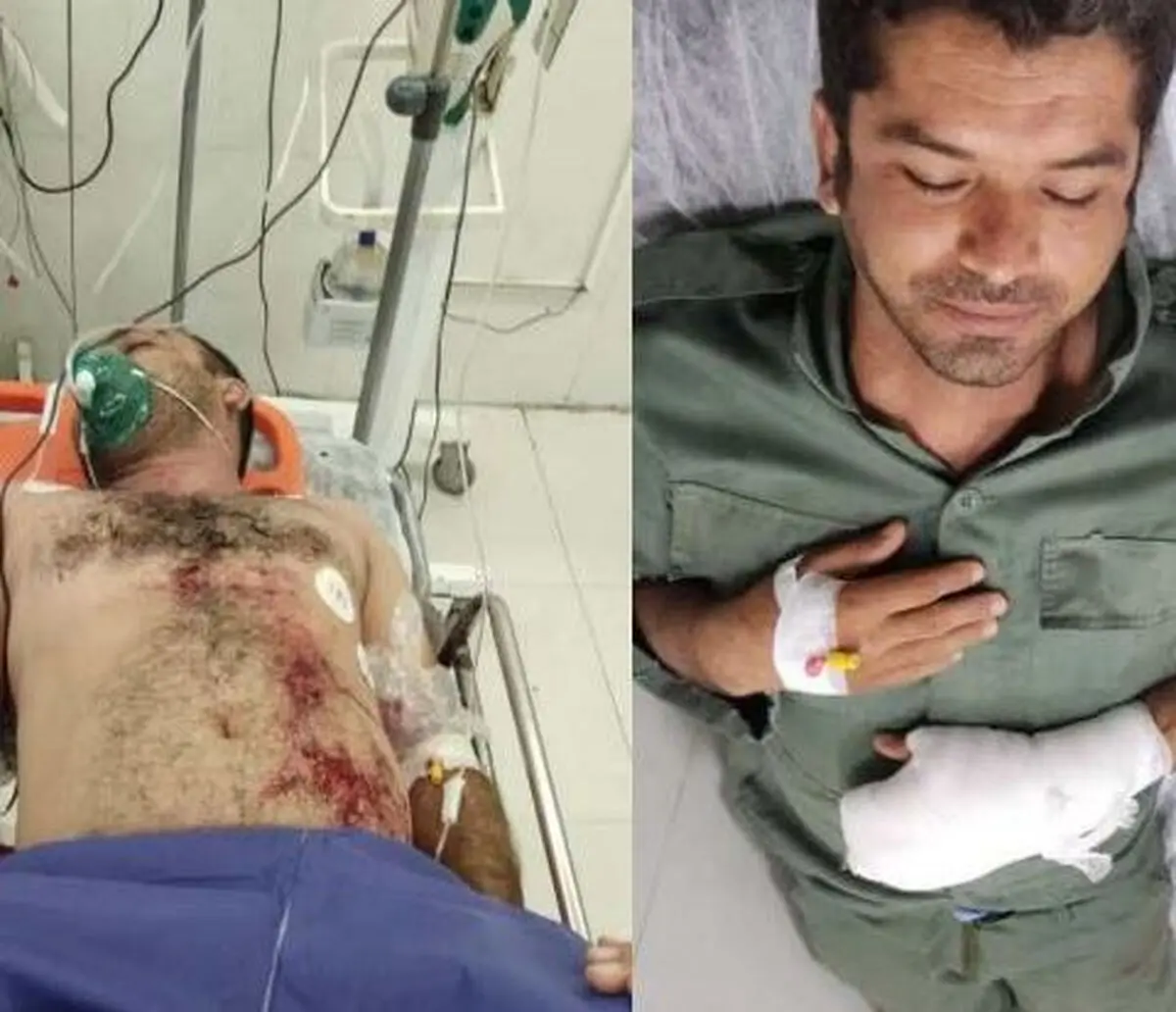 مجروح شدن ۲ محیط بان بوشهری در اثر تیراندازی شکارچیان آهو

