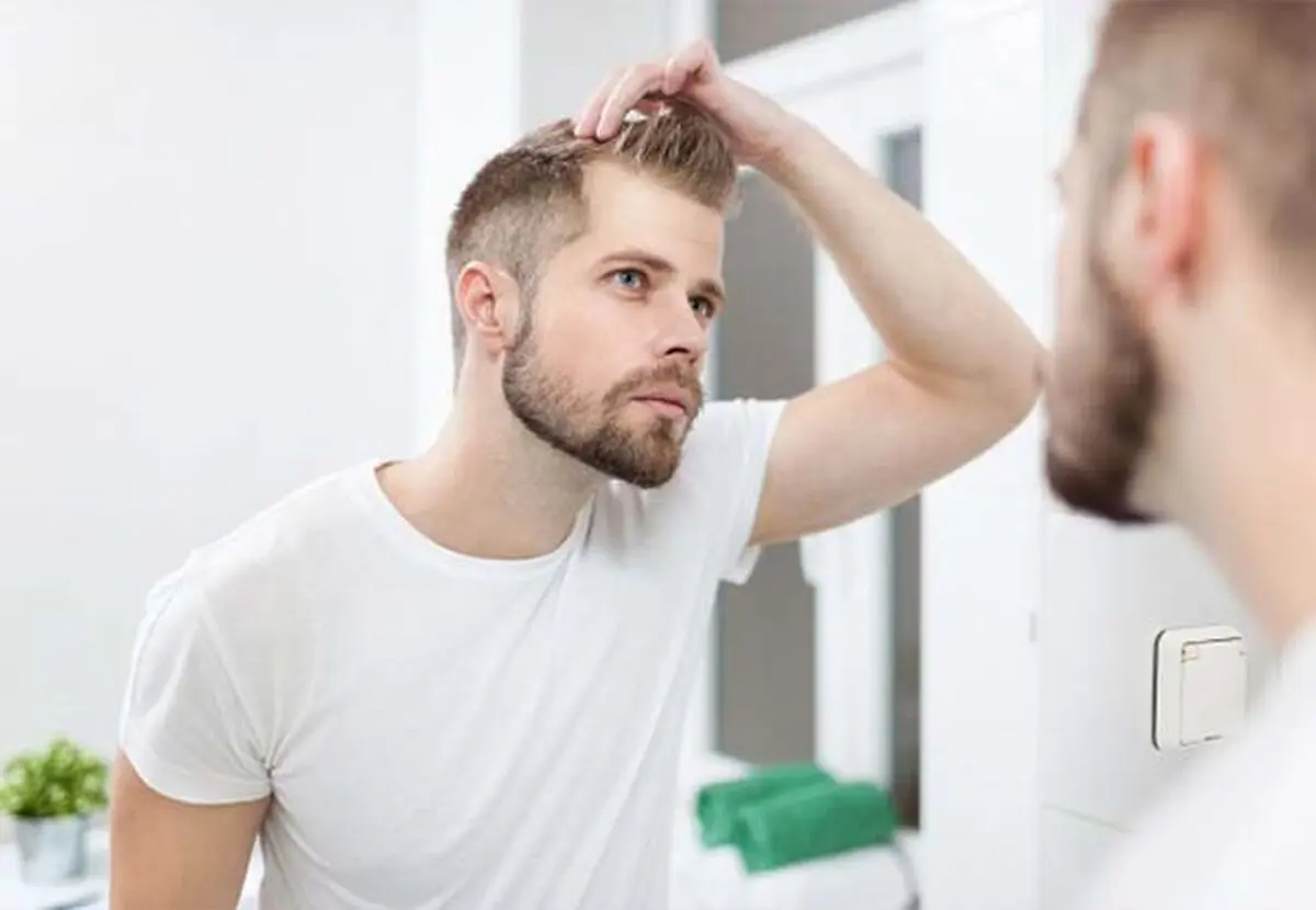5 دلیل قانع کننده برای انجام کاشت مو