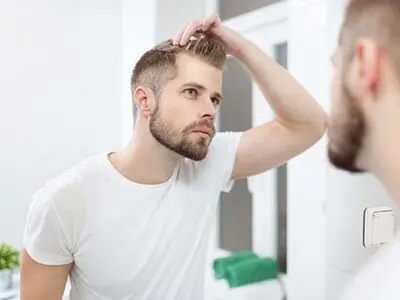 5 دلیل قانع کننده برای انجام کاشت مو