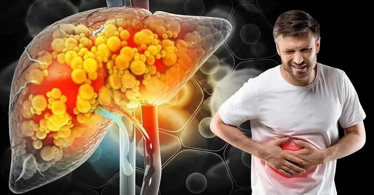 بالاخره با کبد چرب تخم‌مرغ بخوریم یا نه؟
