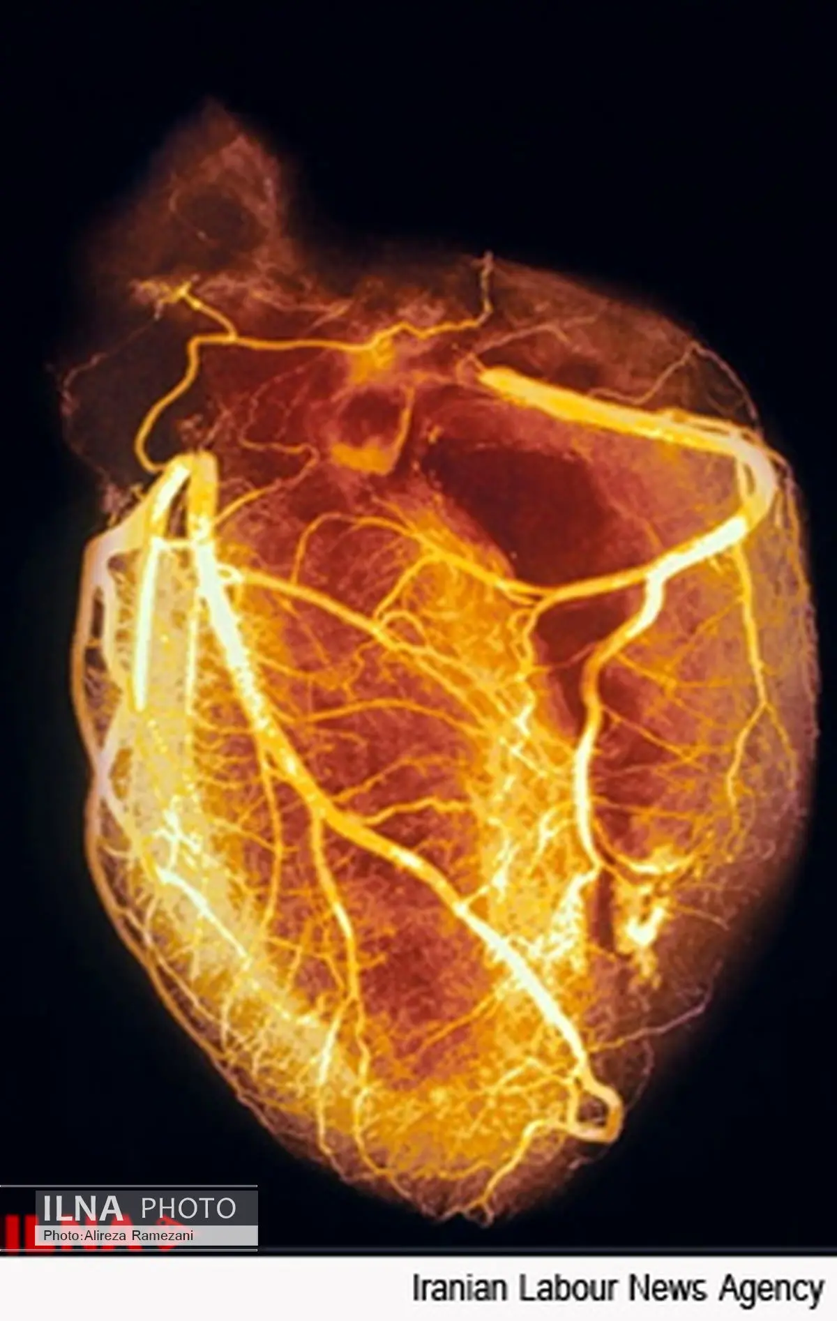 ایست قلبی؛ بیشترین علت فوت تهرانی‌ها در آبان ماه