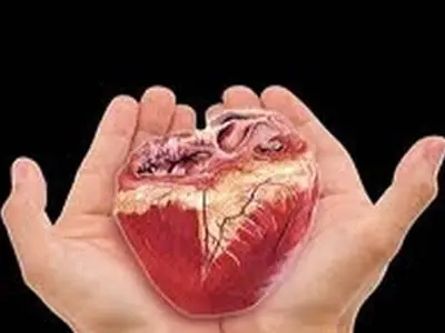 انجام دومین عمل پیوند عضو در سال جدید در خوزستان