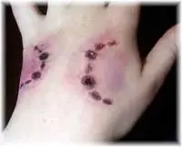 کوهدشت رتبه سوم حیوان گزیدگی را در استان دارد