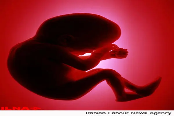  رشد نگران‌کننده سقط جنین‌ در کاشان