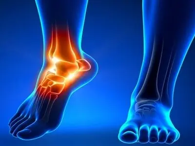 درد‌های مچ پا چه زمانی خطرناک هستند؟