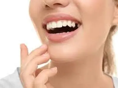چرا جایگزینی دندان های از دست رفته ضروری است + فیلم
