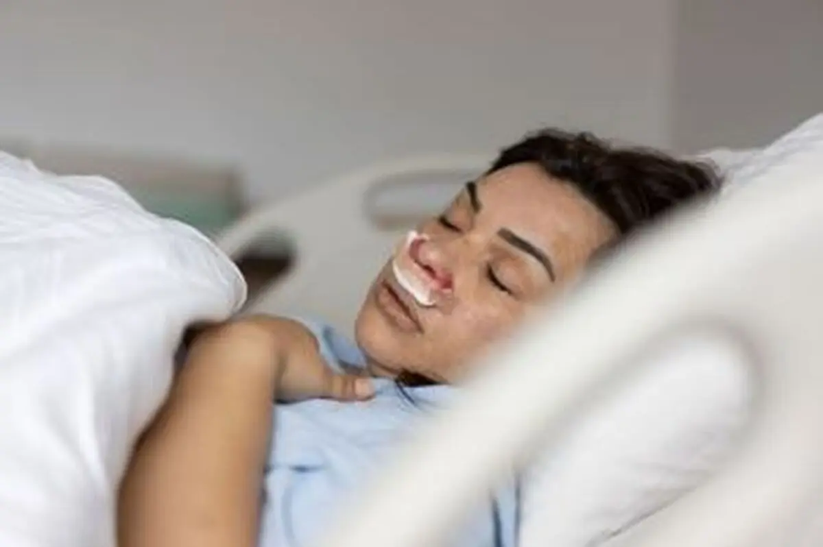 علت حالت تهوع بعد از عمل بینی