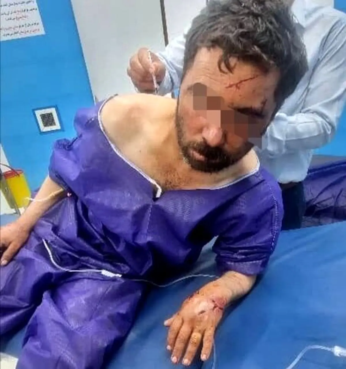 مجروح شدن دامدار جیرفتی بر اثر حمله خرس
