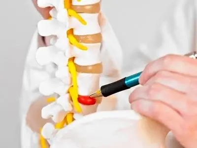 بیماری‌های ستون فقرات | از تشخیص تا رهایی از درد با روش‌های نوین