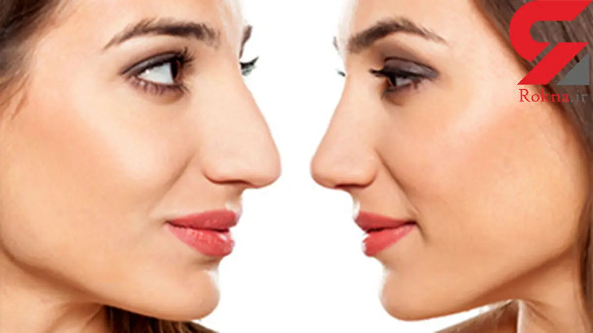 جراحی‌بینی و تزریق بوتاکس در صدر جراحی‌های زیبایی‌/ ارائه یافته‌های جدید علم جراحی پلاستیک و زیبایی