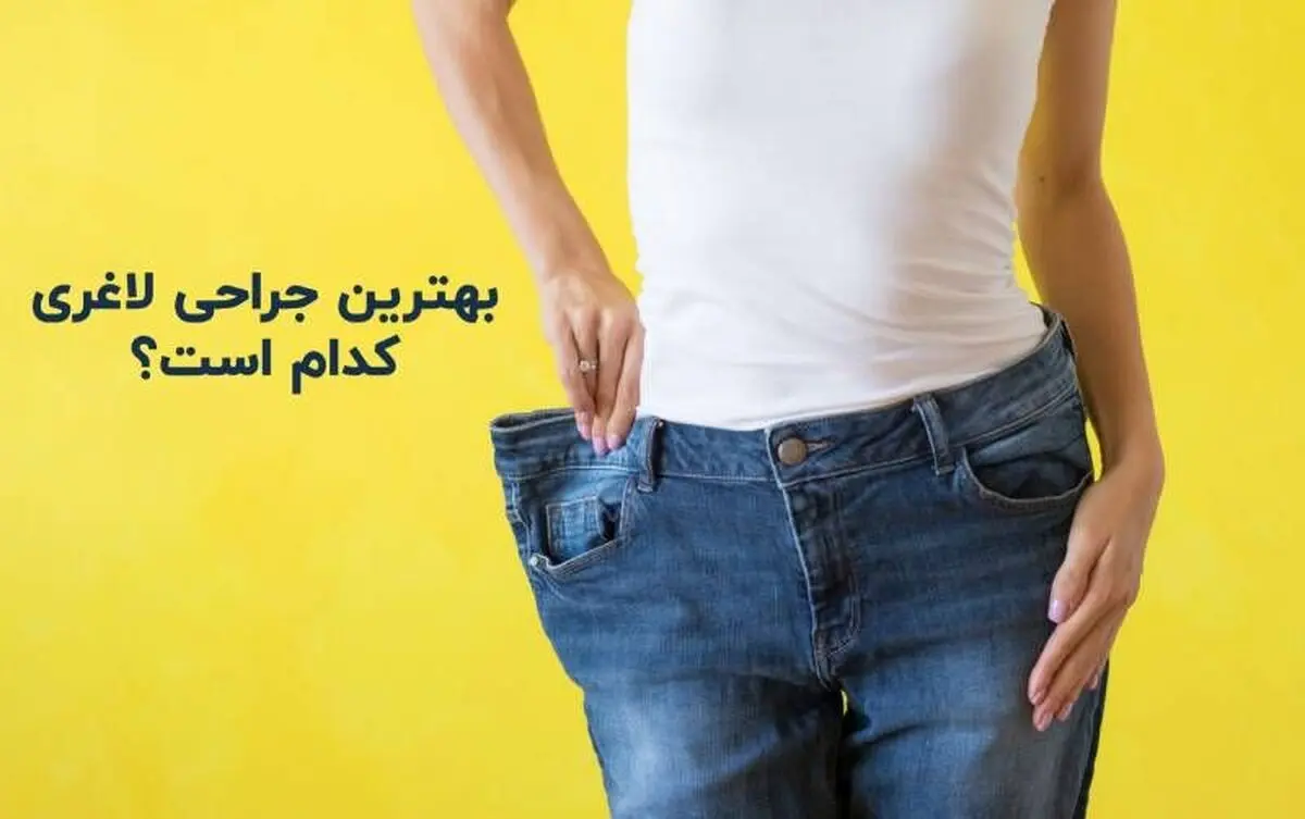 بهترین جراحی لاغری چیست؟ اسلیو یا بای پس معده؟