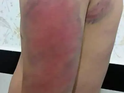 واکنش مجلس به خشونت علیه دانش‌آموزان در مدارس/ آموزش و پرورش از بکارگیری مدیران و معلمانِ کینه‌توز اجتناب کند