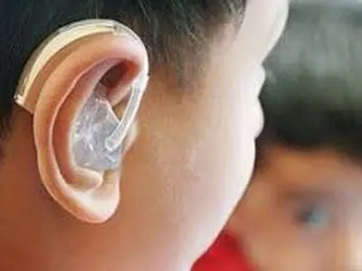وجود بیش از ۷۸۰۰ معلول ناشنوا در کرمانشاه