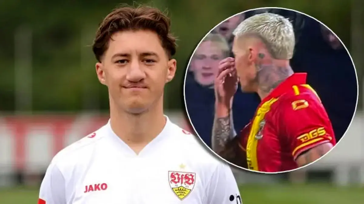 جریمه 500 یورویی برای تمسخر بازیکن اشتوتگارت به دلیل شکاف لب مادرزادی 