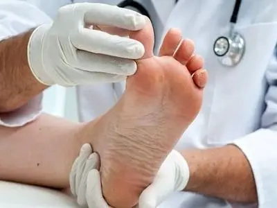 نقرس دقیقا چیست؟