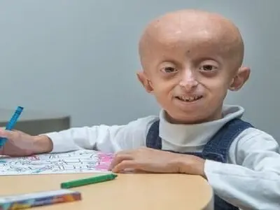 دختربچه ۱۰ ساله بر اثر پیری درگذشت