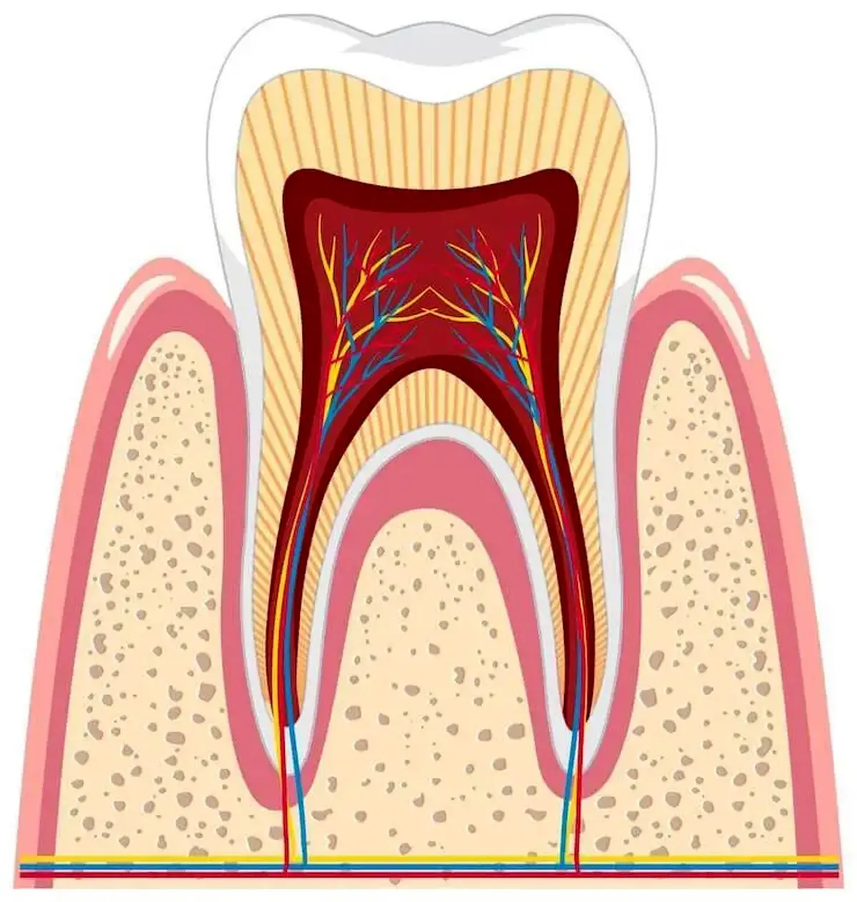 دلیل عفونت ریشه دندان چیست؟