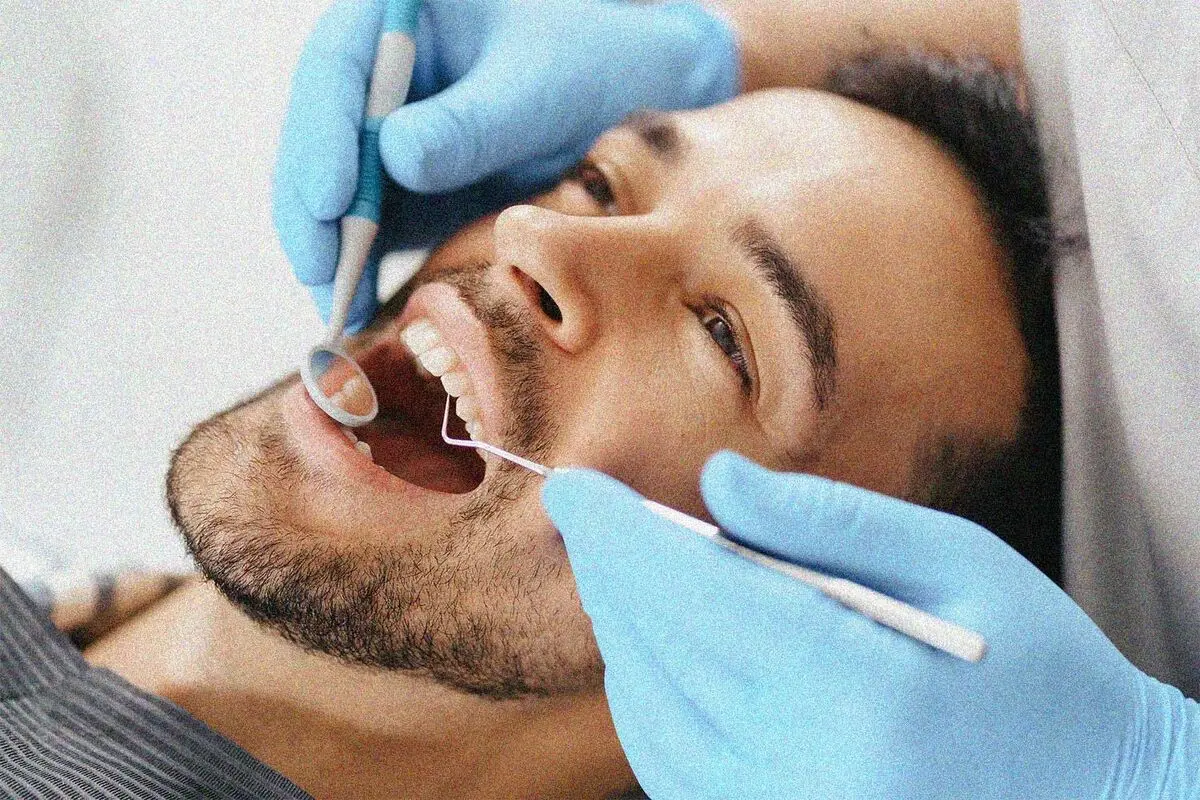 ویژگی های بهترین دکتر  لمینت