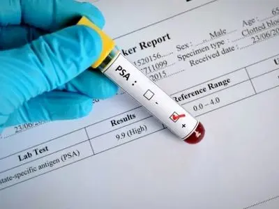 جواب آزمایشتو خودت تفسیر کن؛ هر عدد چه معنایی داره؟+ عکس