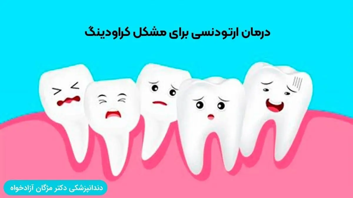 درمان ارتودنسی برای مشکل کراودینگ
