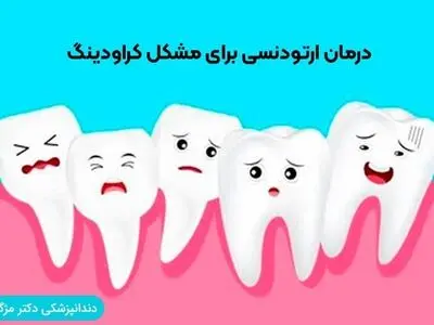 درمان ارتودنسی برای مشکل کراودینگ