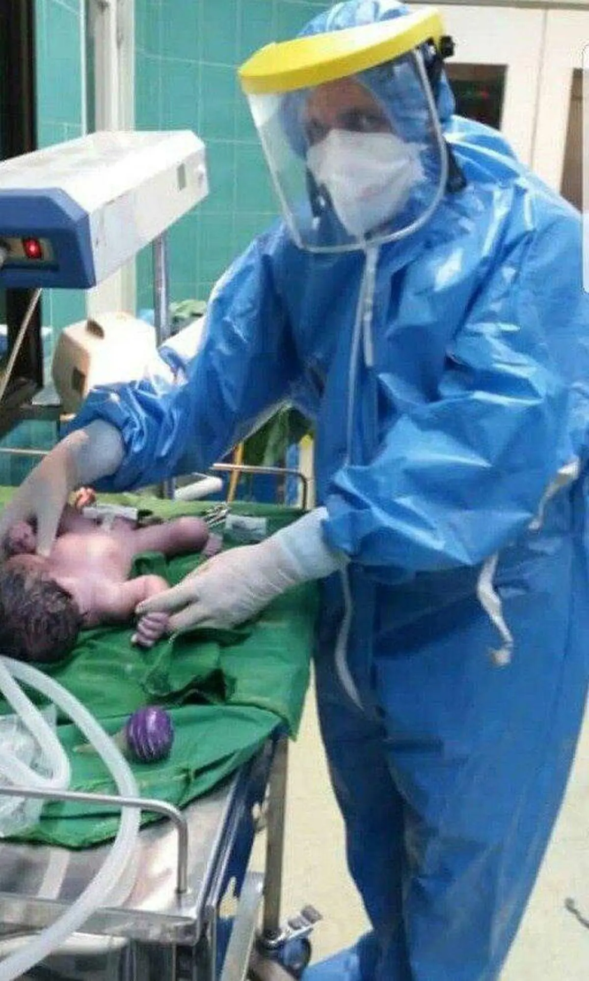 تولد "محمد" از مادر مشکوک به کرونا در سمنان پیام آور امید بود 
