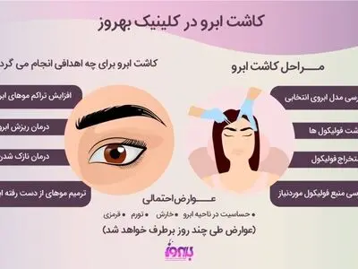 روش های کاشت ابرو و بهترین کلینیک کاشت ابروی تهران
