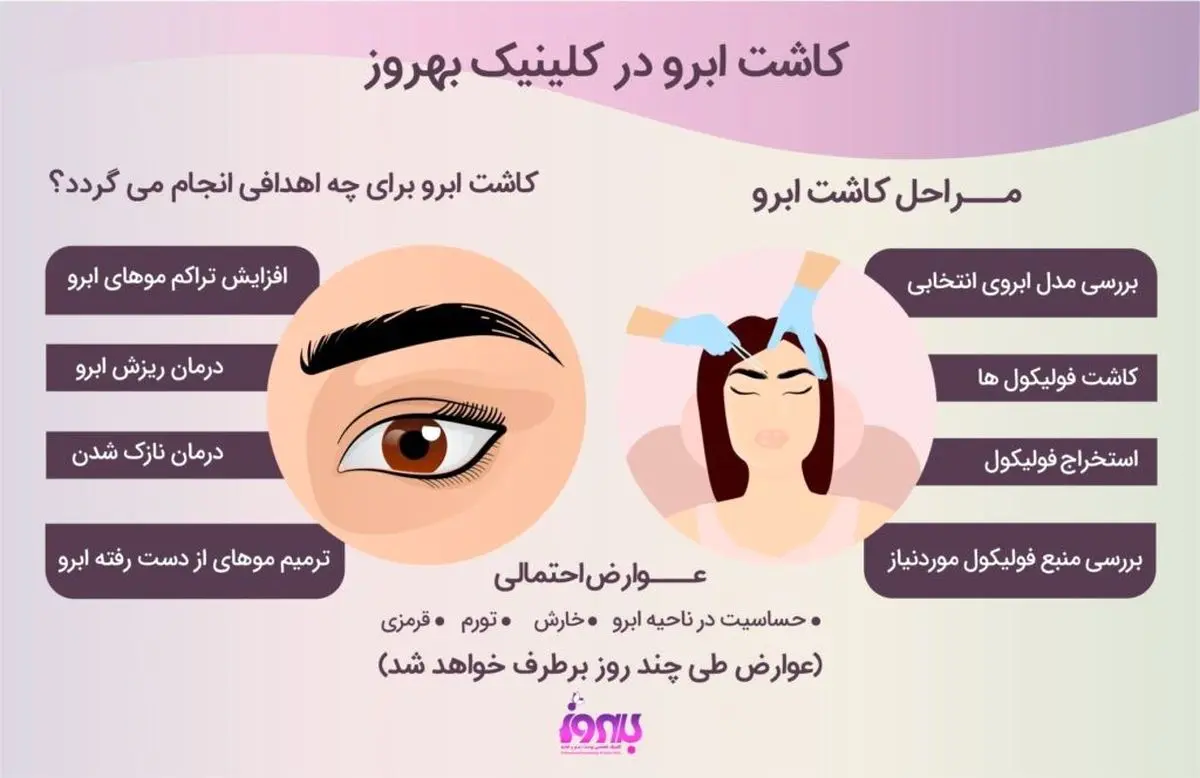 روش های کاشت ابرو و بهترین کلینیک کاشت ابروی تهران