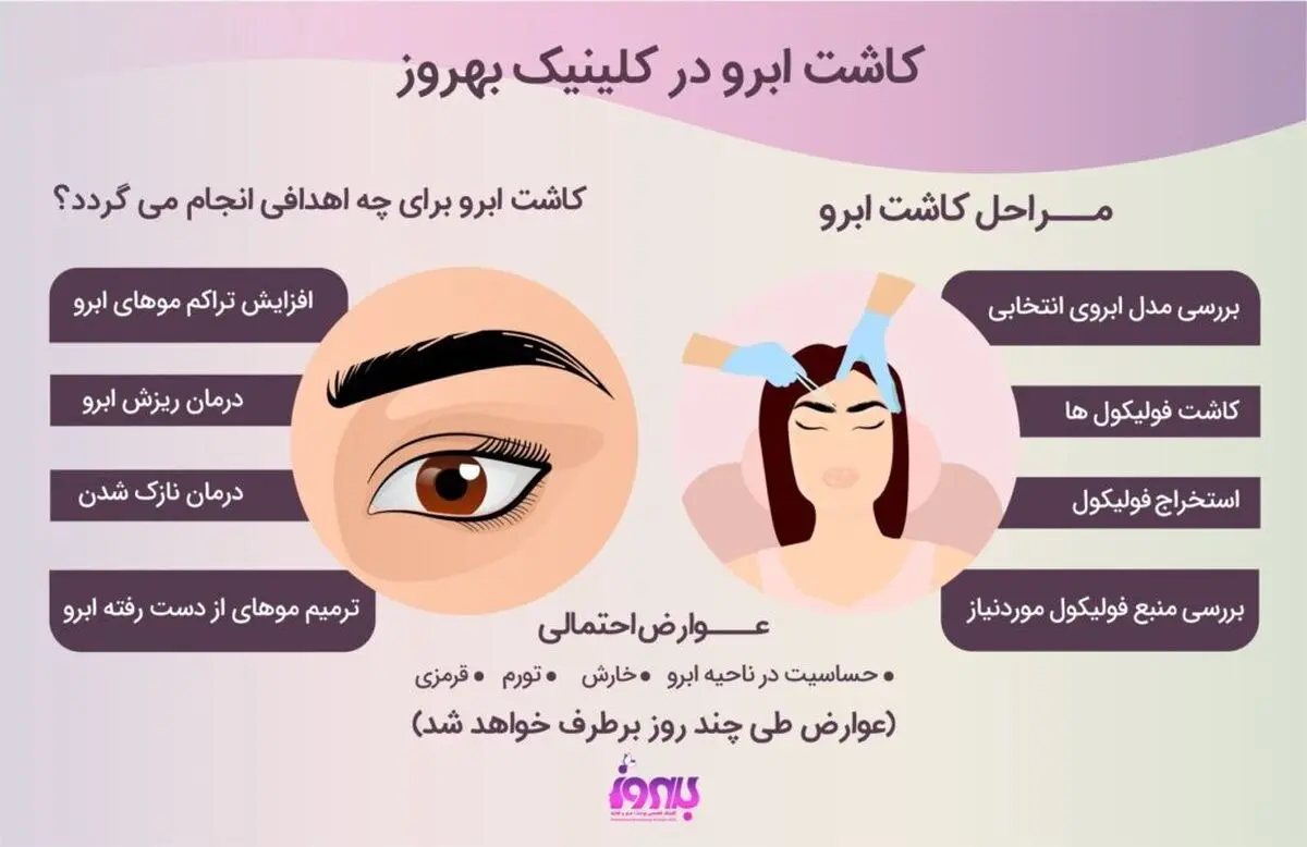 روش های کاشت ابرو و بهترین کلینیک کاشت ابروی تهران