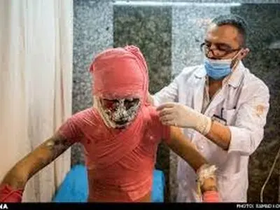 تعداد مصدومین "چهارشنبه سوری" کرمانشاه به 22 نفر رسید