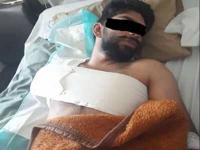 قطع دست کارگر بروجردی از بازو/ حقوق این کارگر فقط شش میلیون تومان بوده است!